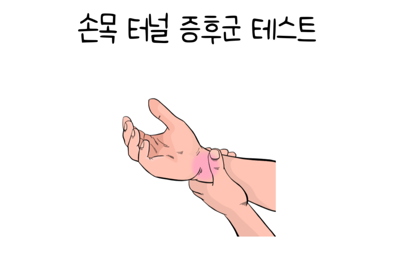 손목 터널 증후군 테스트